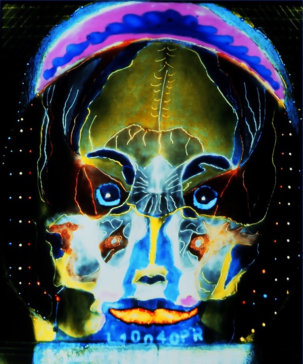 X-Rays, Mixed media