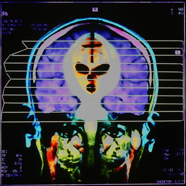 X-Rays, Mixed media