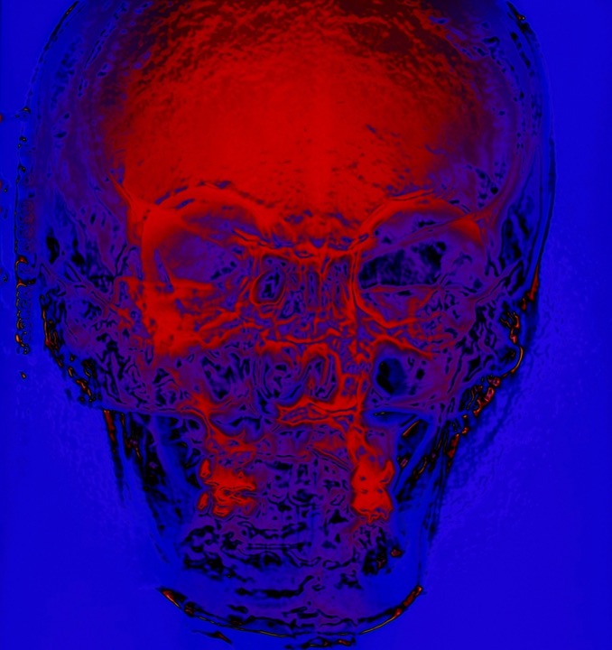 X-Rays, Mixed media