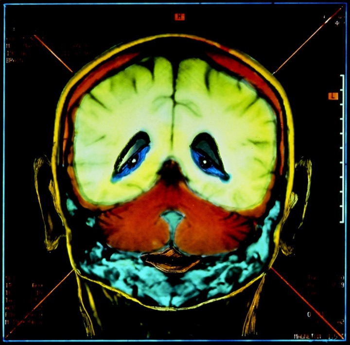 X-Rays, Mixed media