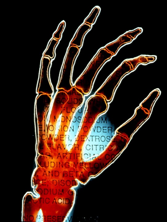 X-Rays, Mixed media