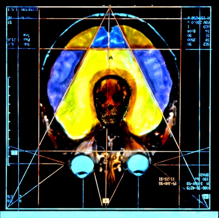 X-Rays, Mixed media