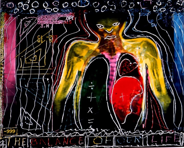 X-Rays, Mixed media